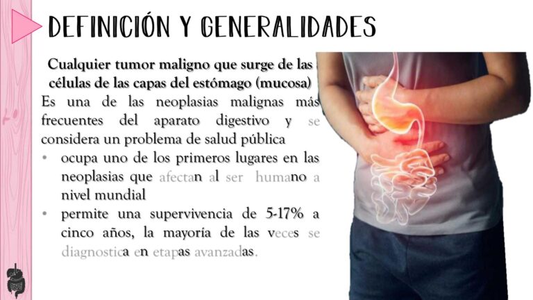 Cáncer gástrico: síntomas, causas y definición esencial