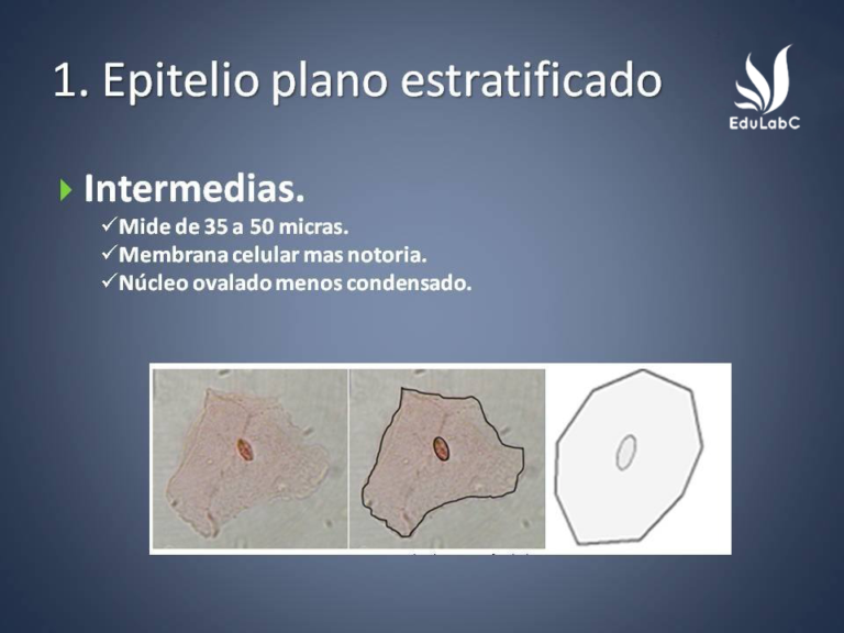 Células epiteliales planas en orina: significado y causas