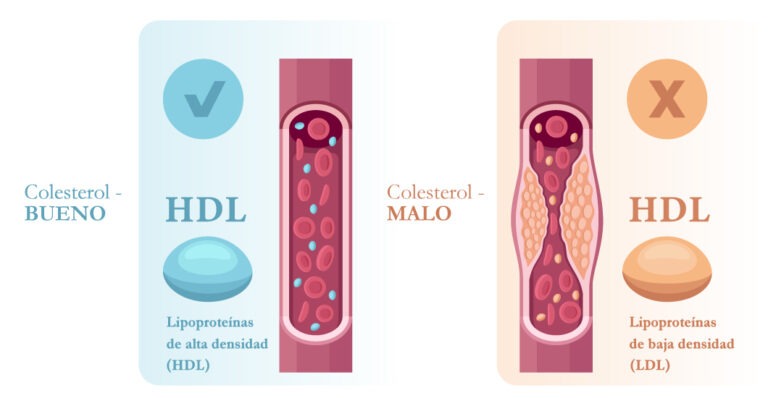 Colesterol VLDL: ¿Qué es y su importancia para la salud?
