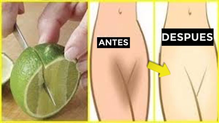 Cómo aclarar entrepierna: 4 remedios naturales efectivos