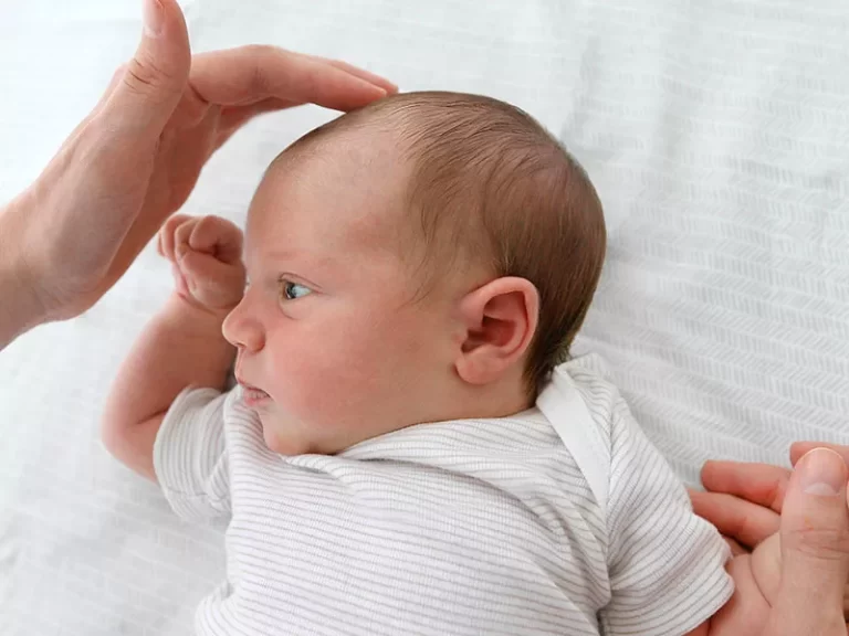 Como se ve una mollera sumida en un bebé: guía esencial