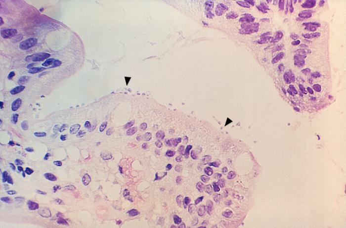 Cryptosporidium: Efectos en la salud y prevención
