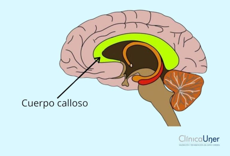 Cuerpo calloso: funciones y características en el cerebro