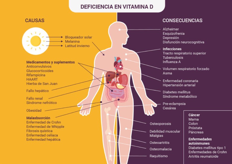 Deficiencia de vitamina D: causas, síntomas y tratamientos