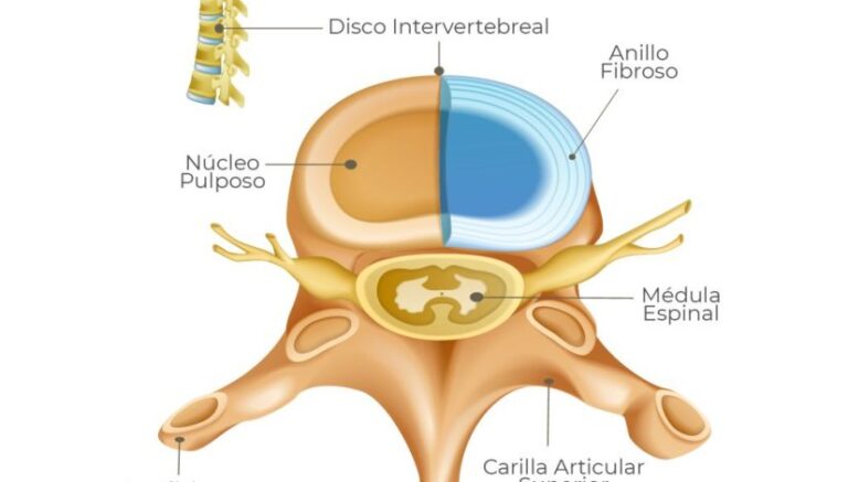 Disco intervertebral: funciones y características esenciales