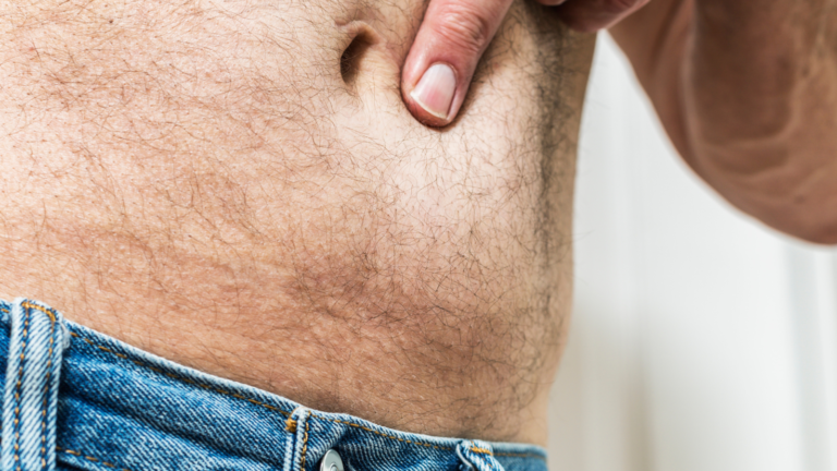 Dolor en ombligo: causas y tratamientos recomendados