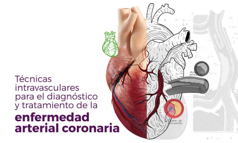 Enfermedad coronaria: síntomas, causas y definición esencial