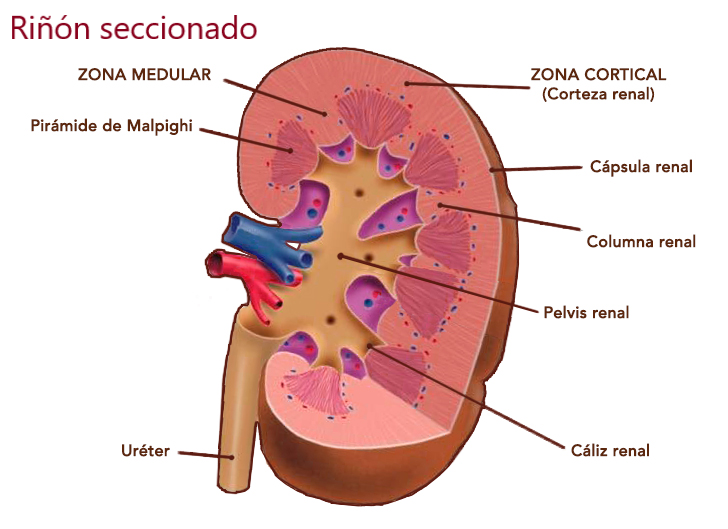 Es grave la ectasia renal en adultos: síntomas y tratamiento