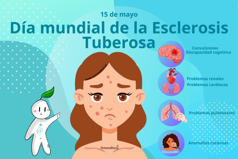 Esclerosis tuberosa: ¿Qué es y cuáles son sus síntomas?
