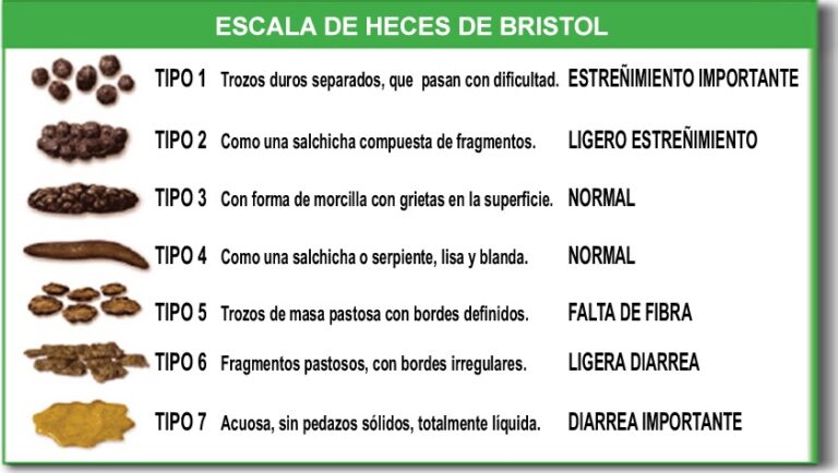 Evacuaciones: ¿Qué son y sus características esenciales?