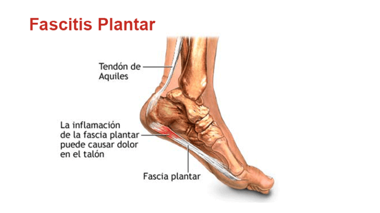 Fascia plantar: funciones y características esenciales