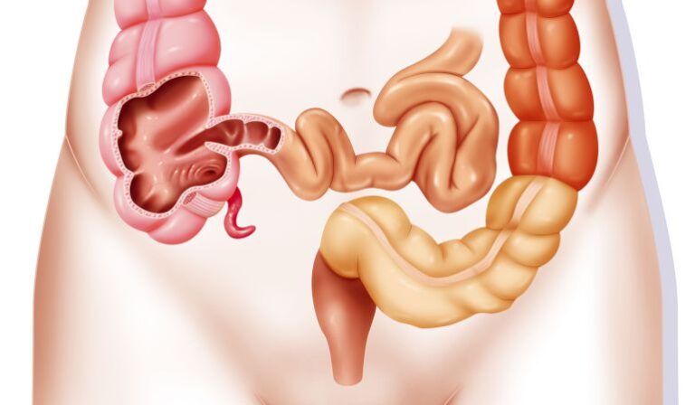 Función apéndice: Importancia y rol en el cuerpo humano
