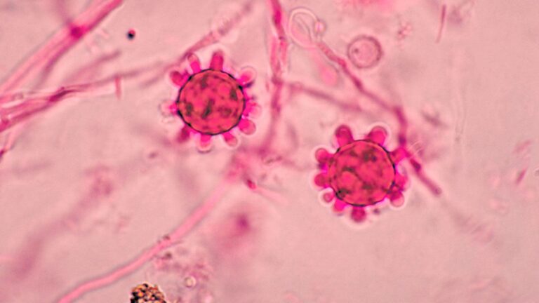Histoplasma: Implicaciones en la salud y síntomas
