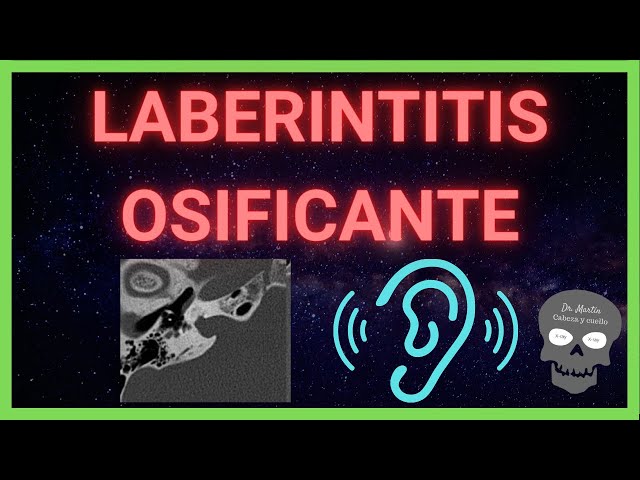 Laberintitis: síntomas, causas y tratamientos explicados