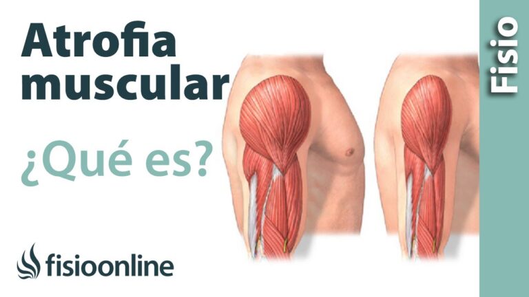 Músculos atrofiados: causas, síntomas y tratamientos explicados