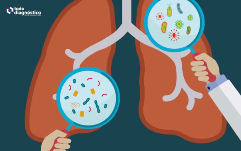 Mycoplasma pneumoniae: efectos en la salud y síntomas