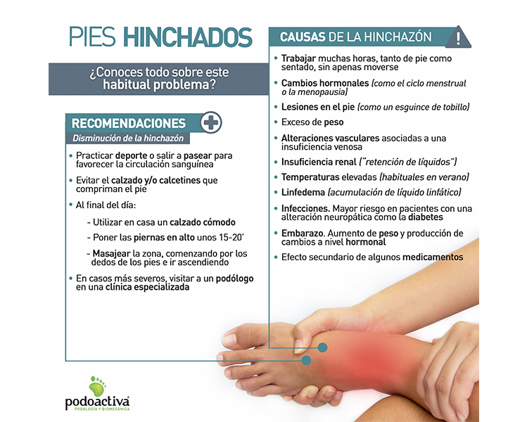 Porque se hinchan las manos y los pies: causas y soluciones