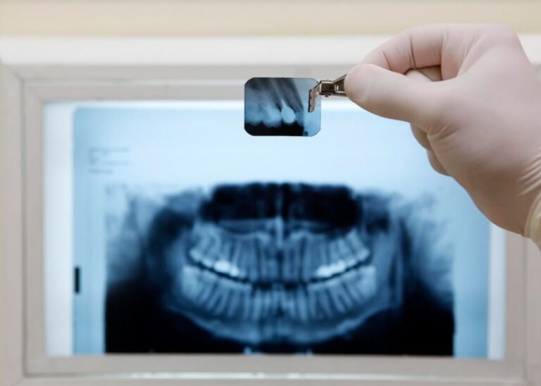 Radiología dental: ¿qué es y para qué se utiliza?