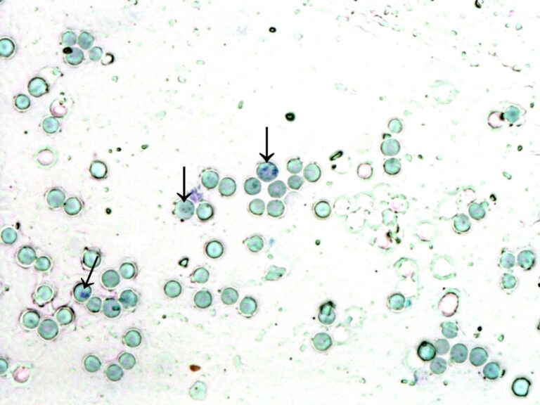 Reticulocitos: Importancia en el análisis de sangre
