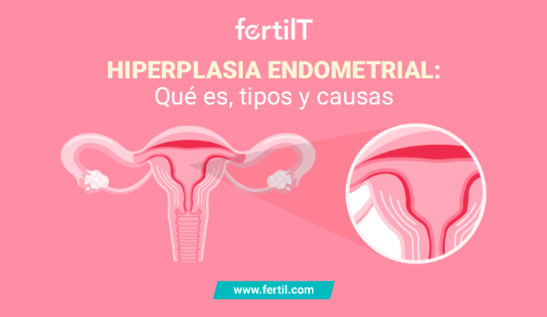 Sangrados uterinos anormales: causas y síntomas explicados