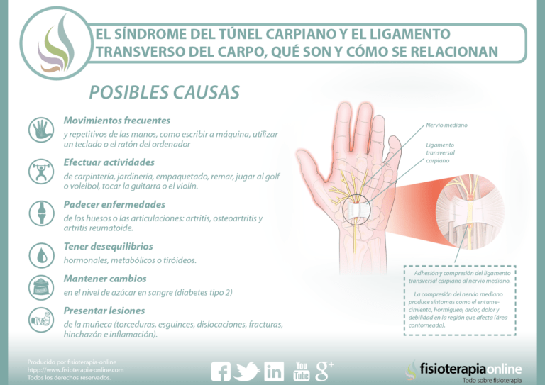 Síndrome del túnel carpiano: síntomas y causas explicadas