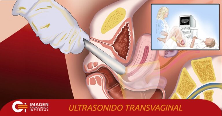 Ultrasonido transvaginal: ¿Qué es y para qué se usa?